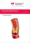1 004 Gerinnungshemmung DE 2016