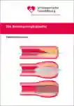 1 019 Koronarangioplastie DE 2020