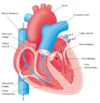 2020 Herz und Herzklappen DE