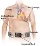 Csm M4 2017 VAD de 5711da3658