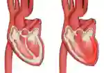 2021 Myocarditis A St184442762