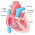 Herzklappenfehler illu 25 FR