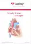 1 031 Herzrhythmusstoerungen DE 2024