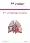 1 094 Pulmonale Hypertonie FR 2025